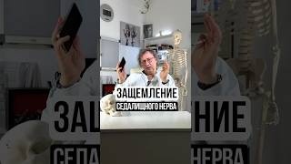 Защемление седалищного нерва