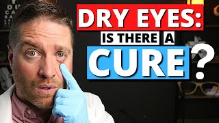DRY EYES: Is There A Cure? - Dry Eye Syndrome Explained