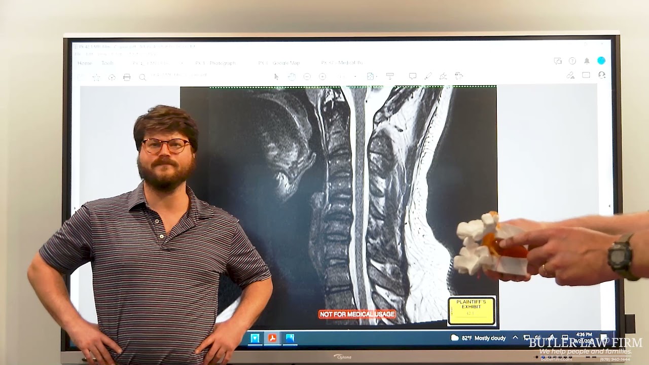 Car Accident: Successful Jury Trial in Car Accident Case