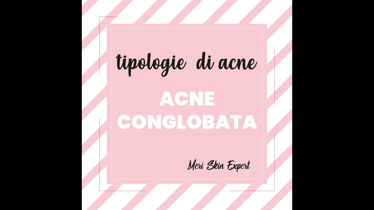 che cos'è l'acne conglobata | Meri Skin Expert | Viva Benessere Torino