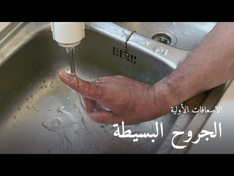 فيديو: ما هي اليد الجرح؟