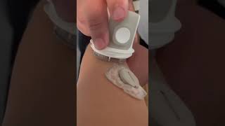 Je change mon dexcom ( capteur)😁