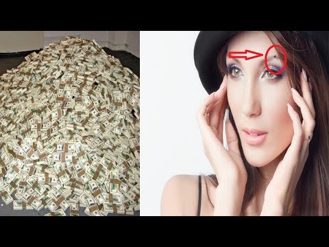 Nốt Ruồi Mọc Ở Tai và Mắt Thì Bạn CỰC MAY CỰC GIÀU TIỀN TÀI ĐẦY NHÀ 😱😱