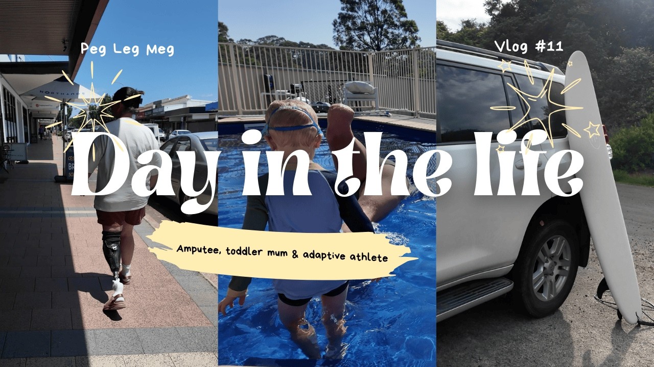 Day in the life | Amputee edition