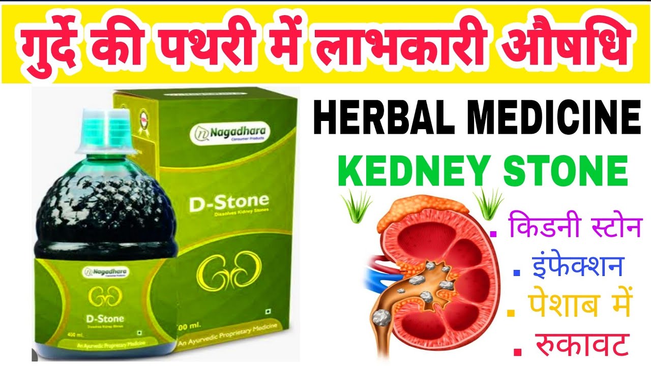 Navsagar Powder Nagadhara D-stone syrup Ayurvedic medicine benefits use in Hindi - YouTube