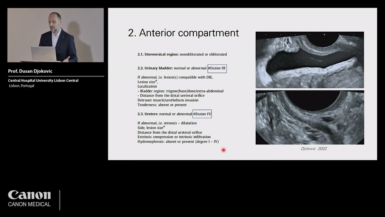 ISUOG 2022 - Prof. Dusan Djokovic - Evaluation of the endometriotic patient