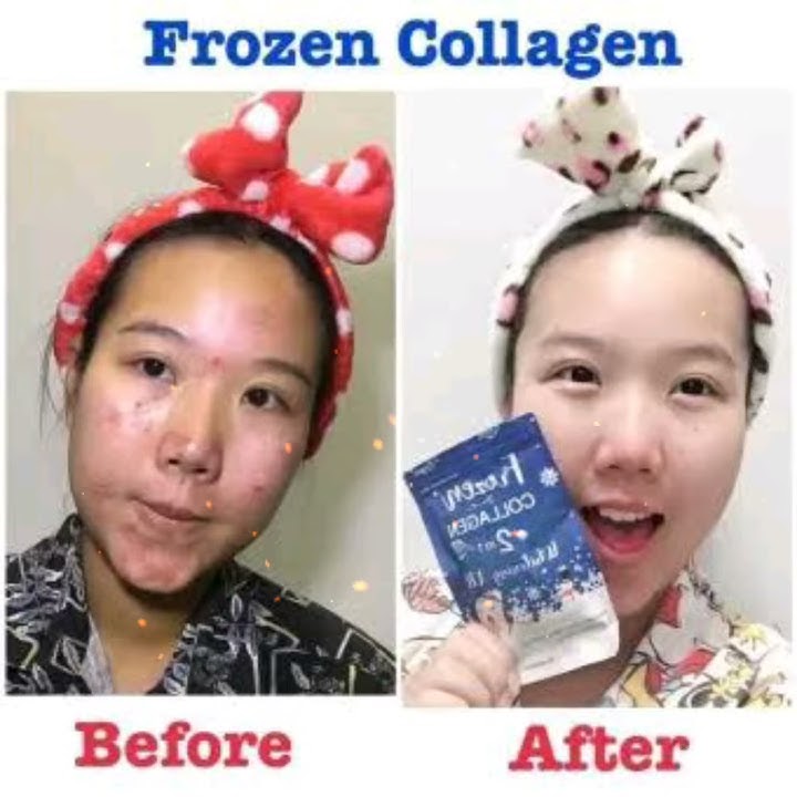 Frozen Detox dietary supplement