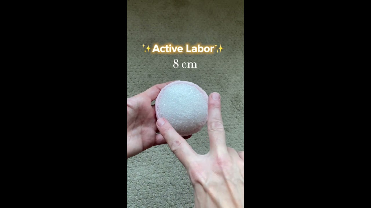 You Cervix And Dilation Childbirtheducation Stagesoflabor Activelabor Earlylabor