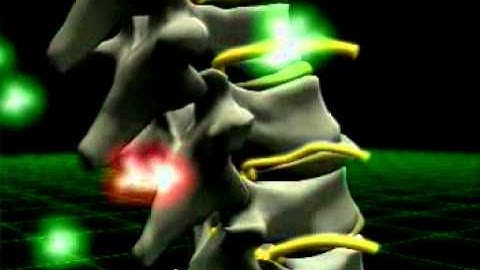 Activator Methods Video.flv