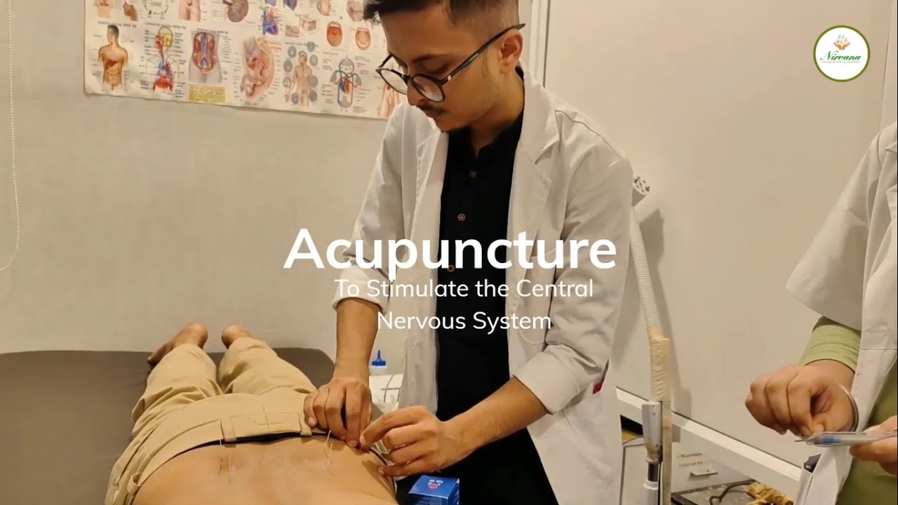 Acupuncture To Stimulate the Central Nervous System - YouTube