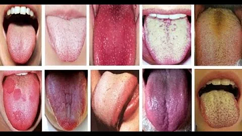 ЯЗЫК — зеркало ОРГАНИЗМА! Узнай о ПРОБЛЕМАХ, чтобы избежать последствий