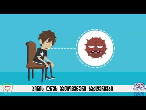 პირის ღრუს სტომატიტი | PERIOBLOG.GE