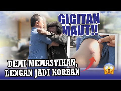 NGERIIIIHHH SEKALI ❗😭 4 GIGI ODGJ MEROB3K LENGAN MAS ADI