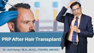 PRP Therapy After Hair Transplant | Hair Transplant in India | Clinic For Hair Transplant