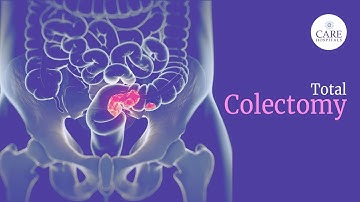 What is Laparoscopic Total Colectomy and How is Total Colectomy Done? | CARE Hospitals