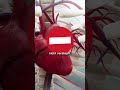 Broken-Heart-Syndrom: Kann man an einem ge... #BrokenHeartSyndrom #Gesundheit #Herzkrankheit #shorts