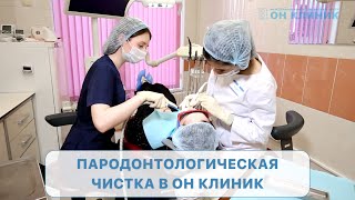 Пародонтологическая чистка в ОН КЛИНИК