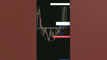 Rounding Bottom Pattern   #trading #forex #crypto #stockmarket #chartpatterns #ufuture #xauusd #btc