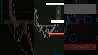 Rounding Bottom Pattern   #trading #forex #crypto #stockmarket #chartpatterns #ufuture #xauusd #btc