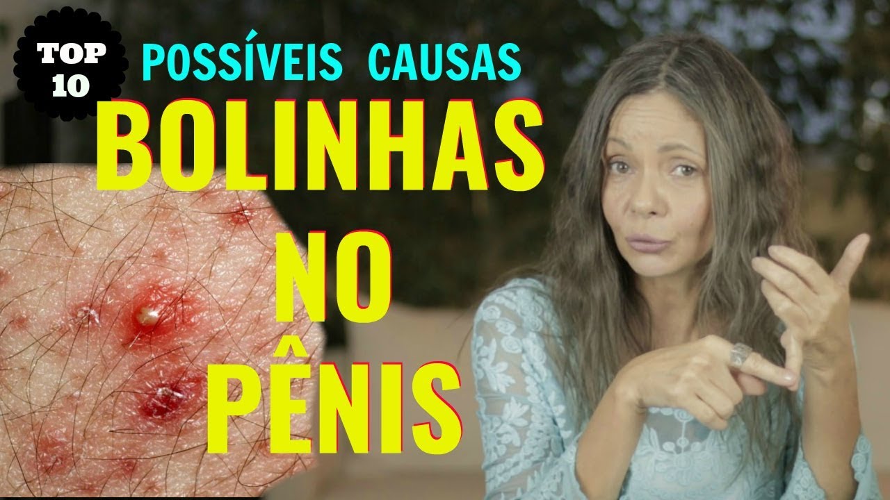 BOLINHAS NO PÊNIS - 10 POSSÍVEIS CAUSAS - YouTube