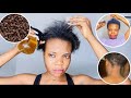 I’m still shocked!!! I USED CLOVE WATER FOR MY HAIR LOSS AND THIS HAPPENED 😱