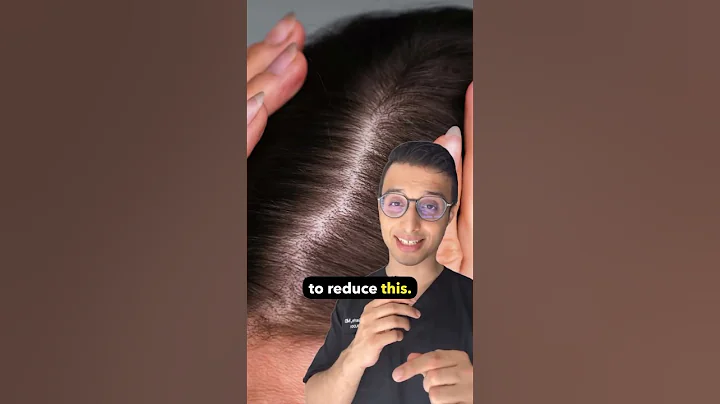 How to treat female Hair Pattern | Dr. Sarin |