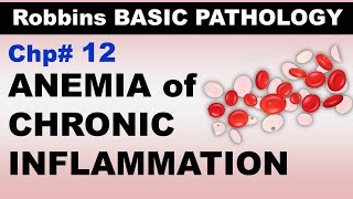 Ch12 | Anemia of Chronic Inflammation | Blood Pathology | Dr Asif Lectures