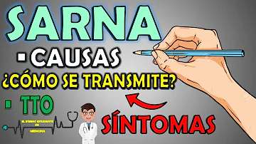 ¿Cuáles son las secuelas de la sarna?