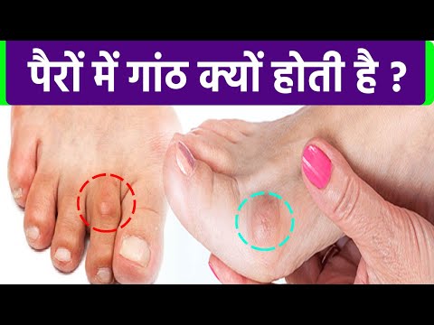 वीडियो: क्या कोचीन में 5 पैर की उंगलियां होती हैं?