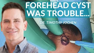 This Forehead Cyst Hurt! | CONTOUR DERMATOLOGY