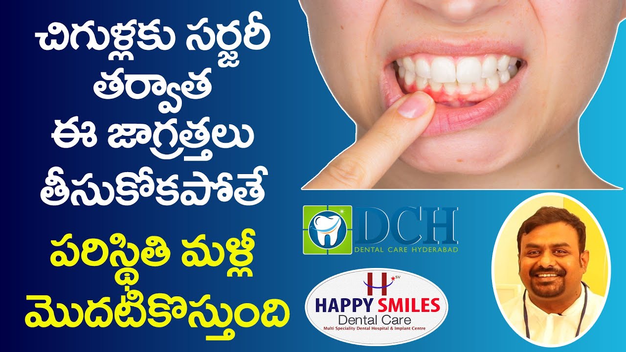 చిగుళ్లకు సర్జరీ తర్వాత ..?  || Precautions After Gum Surgery  || Happy Smiles Dental Care || DCH