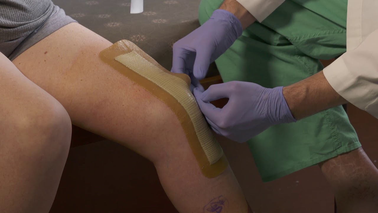 AQUACEL Ag Surgical Application in Office with Dr. Bryan Springer
