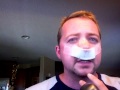 My Brutal Septoplasty Day 2 post op