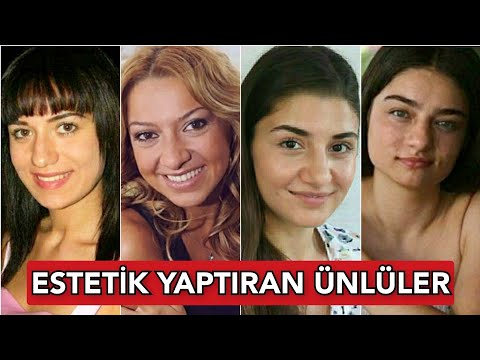 Ünlülerin Şok Olacağınız Estetiksiz Halleri!