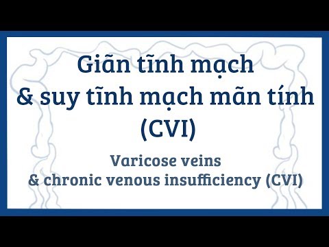 Giãn tĩnh mạch & suy tĩnh mạch mãn tính (CVI) - nguyên nhân, triệu chứng & bệnh lý