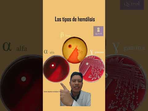 Video: ¿Cómo comprobar si hay hemólisis?