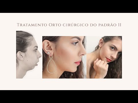 Caso clínico -