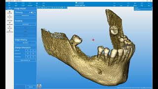 RealGUIDE Software   VOI Setting