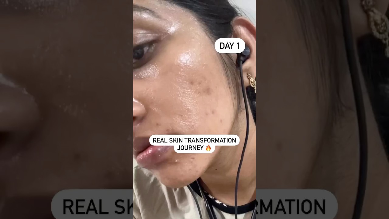 Say goodbye to impurities and hello to radiant skin with 