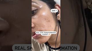 Say goodbye to impurities and hello to radiant skin with #woodoo  Hello Clear Skin #facewash #beauty screenshot 5