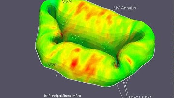Mitral Valve Simulation