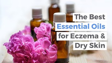 How to Use Essential Oils to Treat Eczema Naturally | The Best Essential Oils for Eczema Treatment