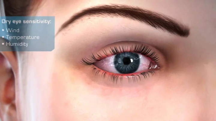 Patient Animation FINAL