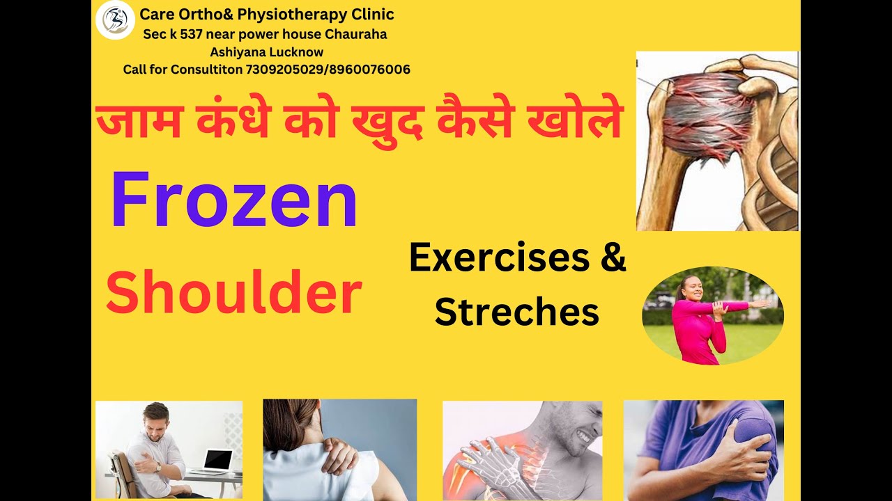 Frozen Shoulder ROM Self Exercises/Shoulder Pain (जाम कंधे को खुद कैसे