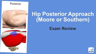 Hip Posterior Approach (Moore or Southern) Exam Review - Doug Padgett, MD