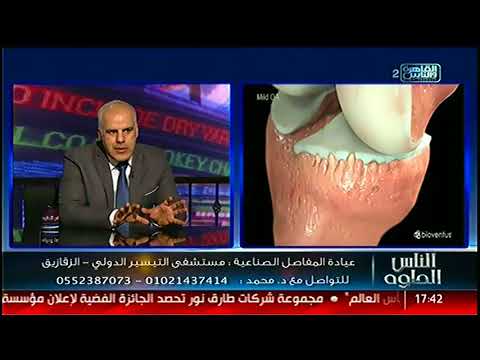 الناس الحلوة مشاكل المفاصل وطرق علاجها مع دكتور محمد عابدين