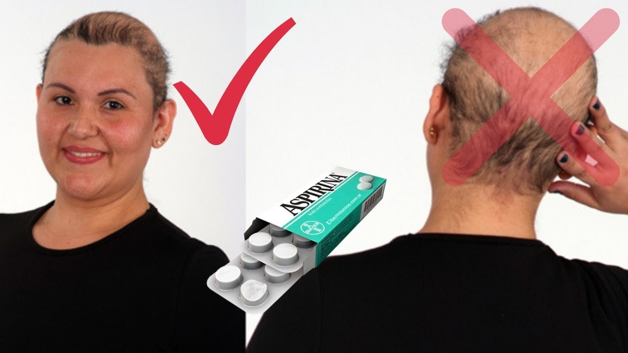 Esta Dama puso Aspirina en el cabello y su pelo Crece como Loco, Realmente increible remedios naturales para la artritis
