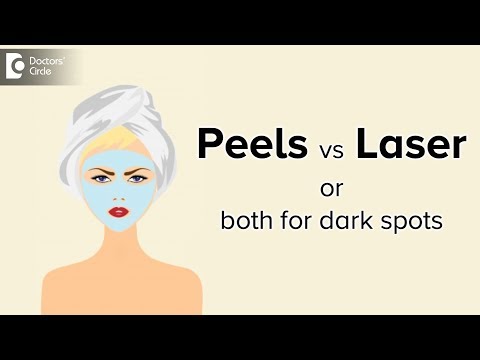 Peels vs Laser or both for dark spots - Dr. Aruna Prasad
