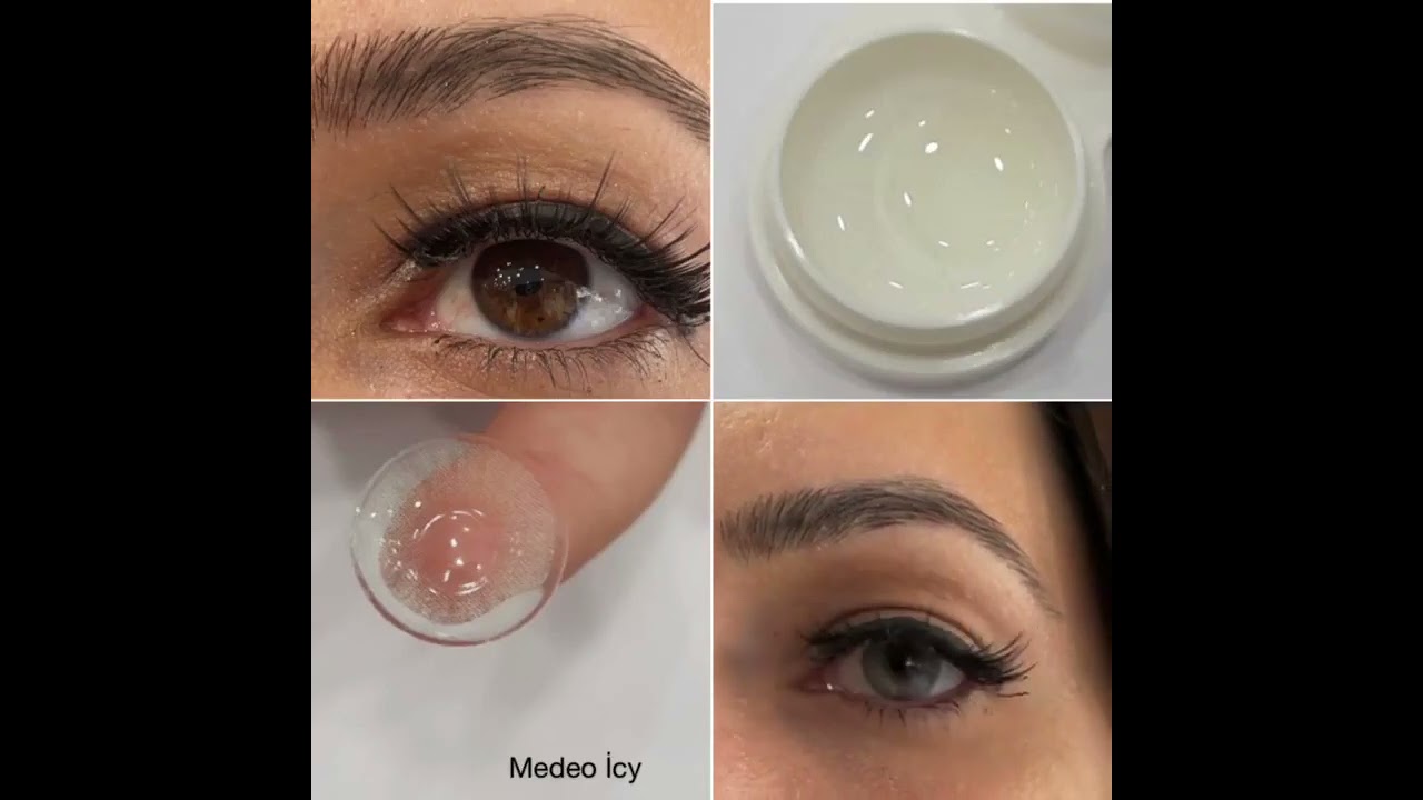 Medeo Icy Haresiz Aylık Lens