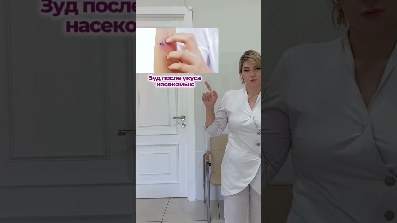О ПОМОЩИ ПРИ УКУСАХ НАСЕКОМЫХ! Читай описание